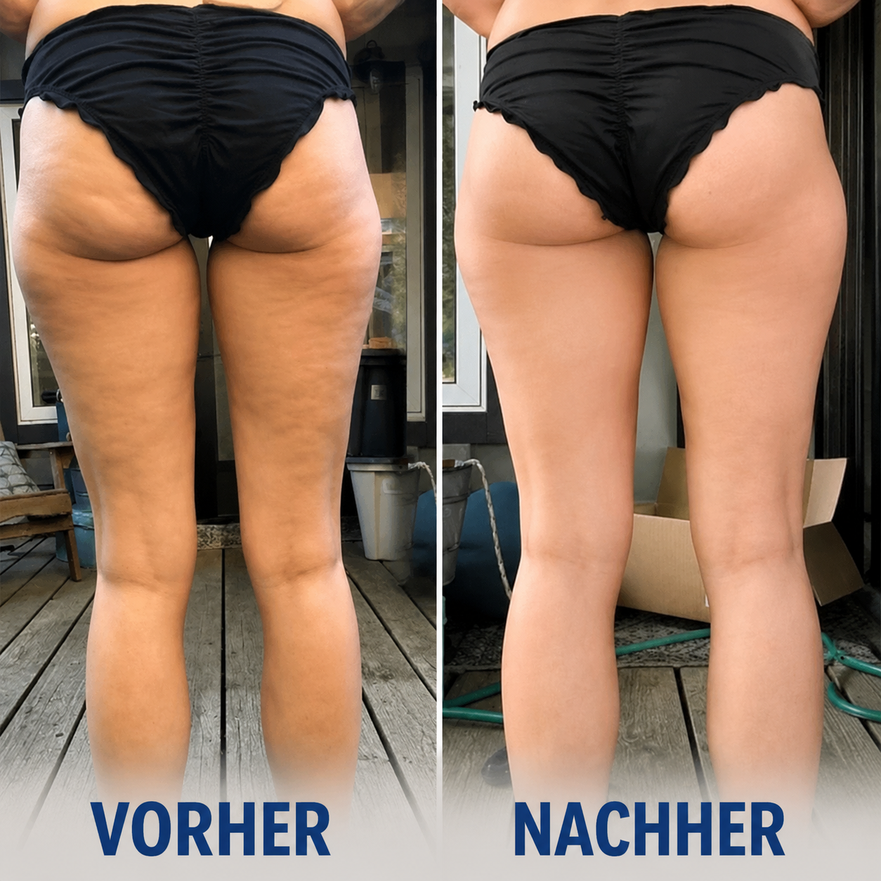 Celluva – glatte Haut in 14 Tagen
